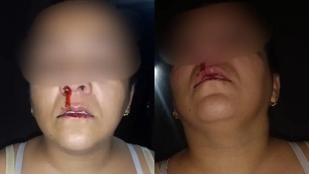 Homem de 30 anos é preso em flagrante após agredir companheira com socos no rosto em Patos