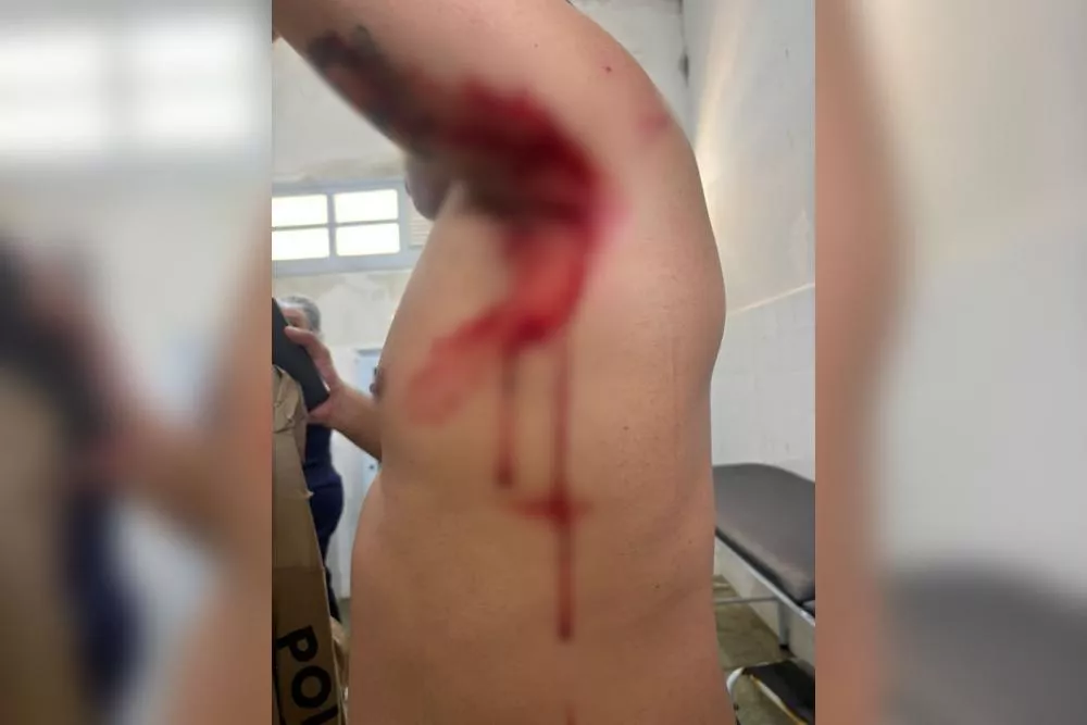 Policial militar fica ferido após ataque de pitbull durante ação que resultou na apreensão de drogas e prisão de suspeito em Teixeira